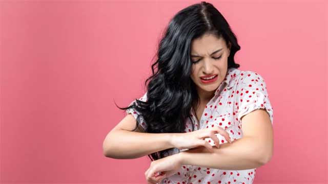 ঘামাচি ও চুলকানি থেকে মুক্তি